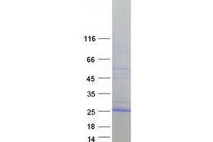 Validation with Western Blot