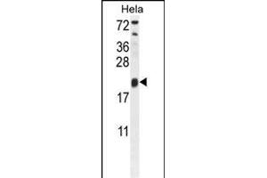 TRPC3 Antibody (N-term) 10175a western blot analysis in Hela cell line lysates (35 μg/lane). (TRAPPC3 anticorps  (N-Term))