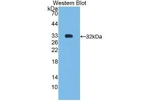 Detection of Recombinant SHP, Human using Polyclonal Antibody to Nuclear Receptor Subfamily 0,Group B,Member 2 (NR0B2)
