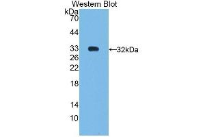 Detection of Recombinant SHP, Human using Polyclonal Antibody to Nuclear Receptor Subfamily 0,Group B,Member 2 (NR0B2) (NR0B2 anticorps  (AA 1-257))