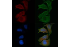 ABIN6257892 and ABIN6274756 staining Hela cells by IF/ICC. (RPS4X anticorps  (Internal Region))