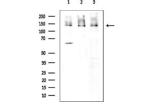 Western blot analysis of lysates from various samples, using  Antibody at 1/1000 dilution. (DDB1 anticorps  (C-Term))