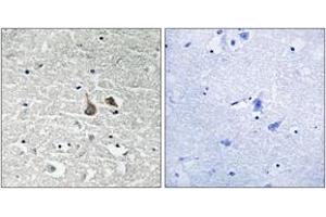 Immunohistochemistry analysis of paraffin-embedded human brain, using IRAK1 (Phospho-Ser376) Antibody. (IRAK1 anticorps  (pSer376))