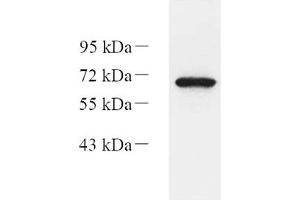 Western blot analysis of Eif2ak1 (ABIN7073875) at dilution of 1: 1000,Lane 1: HEK293 cell lysate (EIF2AK1 anticorps)