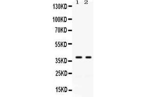 Western blot analysis of GAL4 expression in SW620 whole cell lysates ( Lane 1) and COLO320 whole cell lysates ( Lane 2). (GAL4 anticorps  (C-Term))