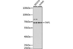 Western blot analysis of extracts of various cell lines, using T antibody (ABIN6131162, ABIN6148845, ABIN6148846 and ABIN6221804) at 1:1000 dilution. (TAP1 anticorps  (AA 524-808))