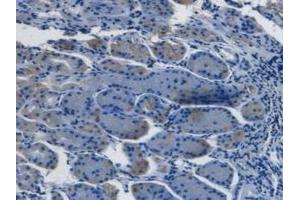 Detection of EDN1 in Human Stomach Tissue using Monoclonal Antibody to Endothelin 1 (EDN1)