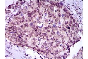Flow cytometric analysis of HeLa cells using MEF2C antibody (green) and negative control (purple). (MEF2C anticorps  (AA 1-125))