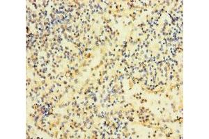 Immunohistochemistry of paraffin-embedded human spleen tissue using ABIN7167200 at dilution of 1:100