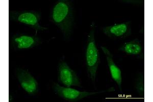 anti-Zinc Finger Protein 181 (ZNF181) (AA 354-461) antibody