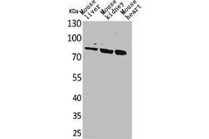 Western Blot analysis of mouse liver mouse kidney mouse heart cells using CUL-4B Polyclonal Antibody (Cullin 4B anticorps  (Internal Region))