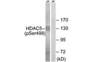 Western blot analysis of extracts from Jurkat cells, using HDAC5 (Phospho-Ser498) Antibody. (HDAC5 anticorps  (pSer498))