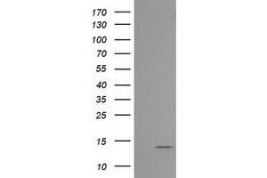 Image no. 1 for anti-Melan A (MLANA) antibody (ABIN1499425) (MLANA anticorps)