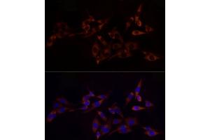 Immunofluorescence analysis of PC-12 cells using RPL10A Rabbit mAb (ABIN7269992) at dilution of 1:100 (40x lens). (RPL10A anticorps)