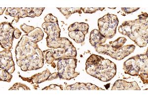 Detection of TGM2 in Human Placenta Tissue using Polyclonal Antibody to Transglutaminase 2 (TGM2)
