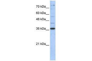 WB Suggested Anti-GAPDH Antibody Titration:  0. (GAPDH anticorps  (Middle Region))