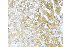 Immunohistochemistry of paraffin-embedded Rat liver using SERPINA3 Polyclonal Antibody at dilution of 1:100 (40x lens). (SERPINA3 anticorps)