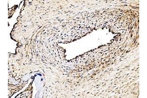 IHC analysis of Glycogen synthase 1/GYS1 using anti-Glycogen synthase 1/GYS1 antibody (ABIN7602155).