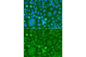 Immunofluorescence analysis of HeLa cells using EPM2A antibody (ABIN5974214). (EPM2A anticorps)