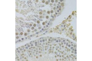 Immunohistochemistry of paraffin-embedded rat testis using HDGF Antibody. (HDGF anticorps  (AA 1-240))