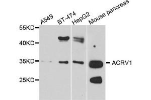 Western blot analysis of extract of various cells, using ACRV1 antibody.