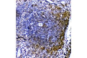IHC analysis of TRAIL using anti-TRAIL antibody (ABIN5519065).