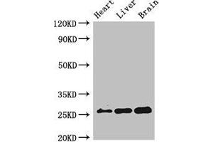 Western Blot Positive WB detected in: Mouse heart tissue, Mouse liver tissue, Mouse brain tissue All lanes: RND2 antibody at 2 μg/mL Secondary Goat polyclonal to rabbit IgG at 1/50000 dilution Predicted band size: 26 kDa Observed band size: 26 kDa (RND2 anticorps  (AA 104-163))