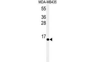 Western blot analysis of hSUMO4-M55 WT specific (R) in MDA-M cell line lysates (35 μg/lane).