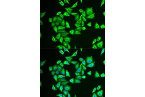 Immunofluorescence (IF) image for anti-Phosphoglucomutase 1 (PGM1) antibody (ABIN1980319) (Phosphoglucomutase 1 anticorps)