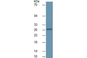 Mouse Capture antibody from the kit in WB with Positive Control: Human heart lysate.