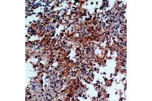 Immunohistochemical analysis of IL-31 staining in human spleen formalin fixed paraffin embedded tissue section. (IL-31 anticorps)