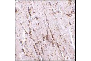 Immunohistochemistry of LIMP2 in human skeletal muscle with this product at 2. (SCARB2 anticorps  (Center))