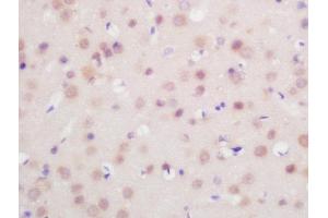 Formalin-fixed and paraffin embedded mouse brain labeled with Rabbit Anti-FoxP1 Polyclonal Antibody, Unconjugated  at 1:200 followed by conjugation to the secondary antibody and DAB staining (FOXP1 anticorps  (AA 581-705))