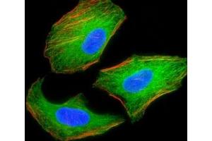 Fluorescent image of HeLa cells stained with TSC2 antibody.