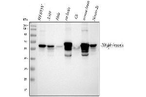 Western blot analysis of Alpha Internexin using anti-Alpha Internexin antibody (ABIN4886634).