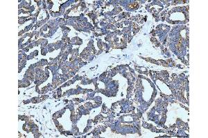 IHC analysis of Neurofibromin/NF1 using anti-Neurofibromin/NF1 antibody (ABIN7600197). (Neurofibromin 1 anticorps  (AA 160-270))
