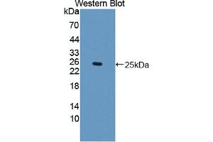 Western blot analysis of the recombinant protein. (IFNE anticorps  (AA 30-208))