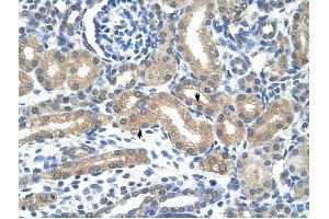 HIF3A antibody was used for immunohistochemistry at a concentration of 4-8 ug/ml to stain Epithelial cells of renal tubule (arrows) in Human Kidney.