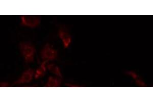 ABIN6277840 staining Hela by IF/ICC. (CD22 anticorps)