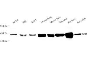 Western blot analysis of ECI2 (ABIN7073837) at dilution of 1: 500