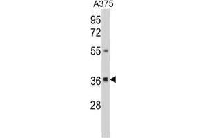 Western blot analysis of GALE Antibody (Center) in A375 cell line lysates (35 µg/lane). (GALE anticorps  (Middle Region))