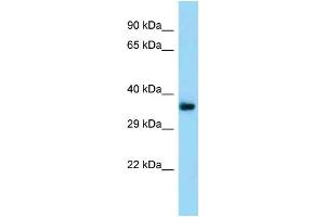 Western Blotting (WB) image for anti-Transmembrane Protein 164 (TMEM164) (N-Term) antibody (ABIN2788478) (TMEM164 anticorps  (N-Term))