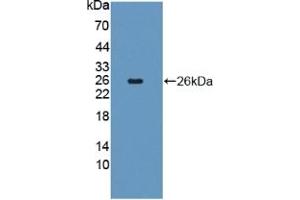 Detection of Recombinant FGF18, Human using Polyclonal Antibody to Fibroblast Growth Factor 18 (FGF18) (FGF18 anticorps  (AA 28-207))