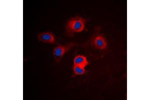 Immunofluorescent analysis of BCLX staining in Jurkat cells. (BCL2L1 anticorps  (Center))