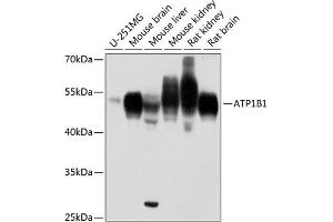 Western blot analysis of extracts of various cell lines, using B1 antibody (ABIN6127387, ABIN6137304, ABIN6137307 and ABIN6216023) at 1:1000 dilution.
