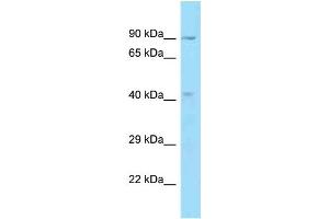 WB Suggested Anti-OBFC1 Antibody Titration: 1. (OBFC1 anticorps  (C-Term))