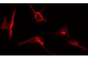 ABIN6277063 staining  HepG2 cells by IF/ICC. (FGFR1 anticorps  (C-Term))