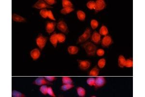 Immunofluorescence analysis of HeLa cells using SLC25A5 Polyclonal Antibody at dilution of 1:100 (40x lens). (SLC25A5 anticorps)