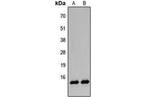 Western blot analysis of Histone H2B (AcK12) expression in A431 TSA-treated (A), HeLa TSA-treated (B) whole cell lysates. (Histone H2B anticorps  (acLys12, N-Term))