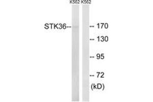 Western blot analysis of extracts from K562 cells, using STK36 Antibody. (STK36 anticorps  (AA 387-436))